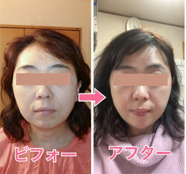 小顔矯正・目元美容マツエクサロン「ルシェルシェ」＜福井県福井市＞