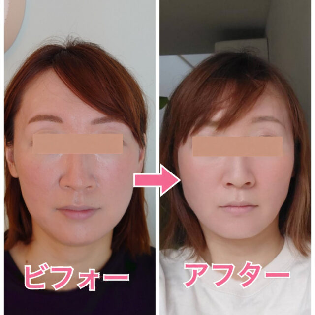 小顔矯正・目元美容マツエクサロン「ルシェルシェ」＜福井県福井市＞