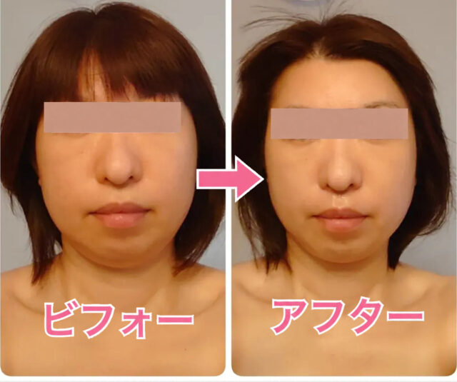 小顔矯正・目元美容マツエクサロン「ルシェルシェ」＜福井県福井市＞