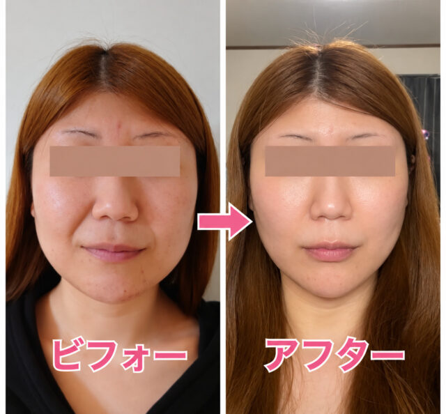 小顔矯正・目元美容マツエクサロン「ルシェルシェ」＜福井県福井市＞