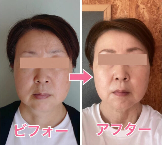 小顔矯正・目元美容マツエクサロン「ルシェルシェ」＜福井県福井市＞
