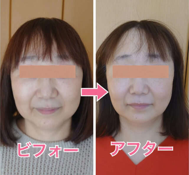 小顔矯正・目元美容マツエクサロン「ルシェルシェ」＜福井県福井市＞